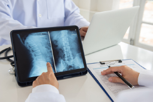Katy Spinal Cord Injuries Lawyers
